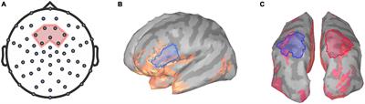 Neural responses to naturalistic audiovisual speech are related to listening demand in cochlear implant users